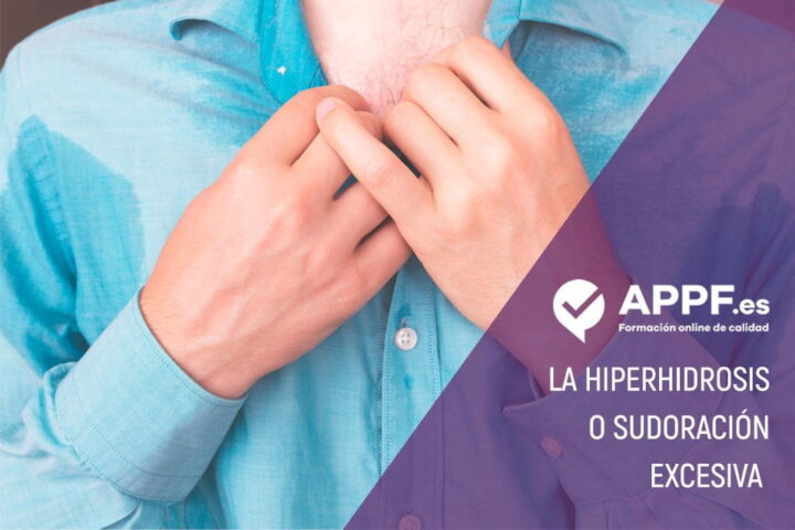 Cómo evitar sudar en exceso ¿Qué es la hiperhidrosis?