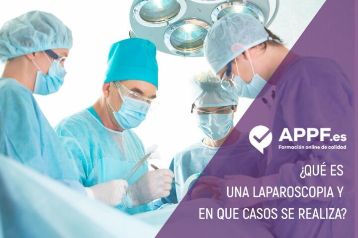 laparoscopia : información para opositores de sanidad