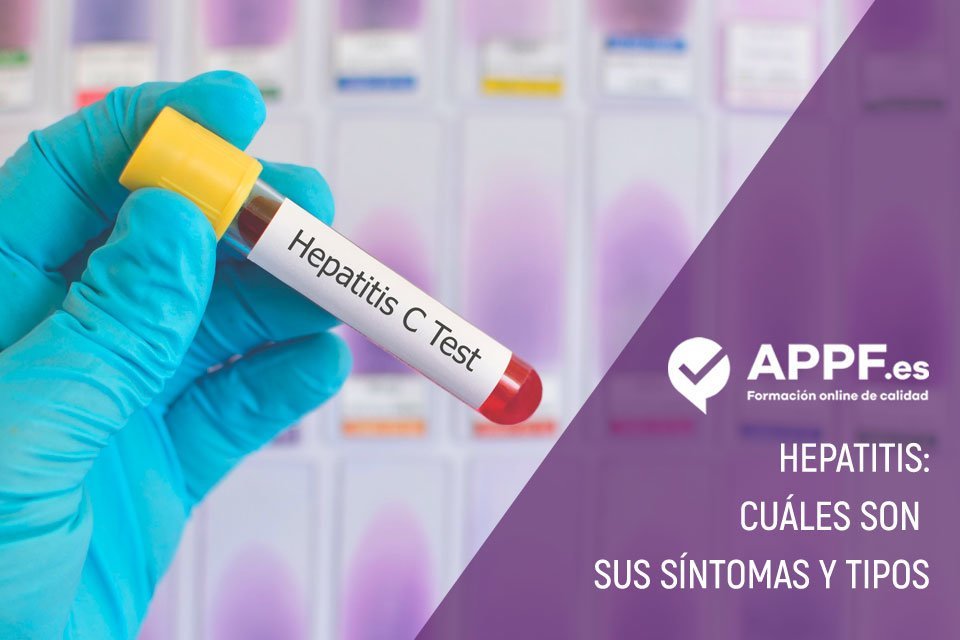hepatitis a y perdida de peso hepatitis a y perdida de peso